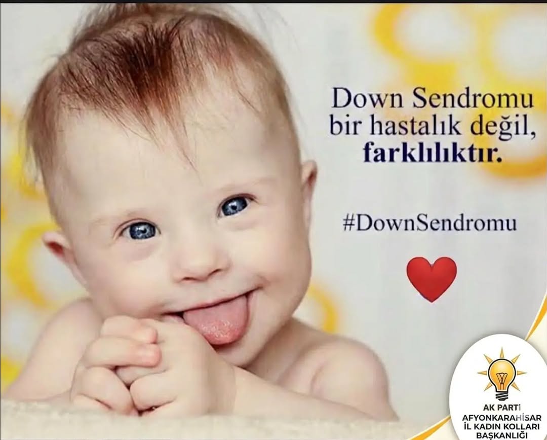 21 Mart Dünya Down Sendromu Farkındalık Günü: Farklılıkların Hayatımıza Katkısı