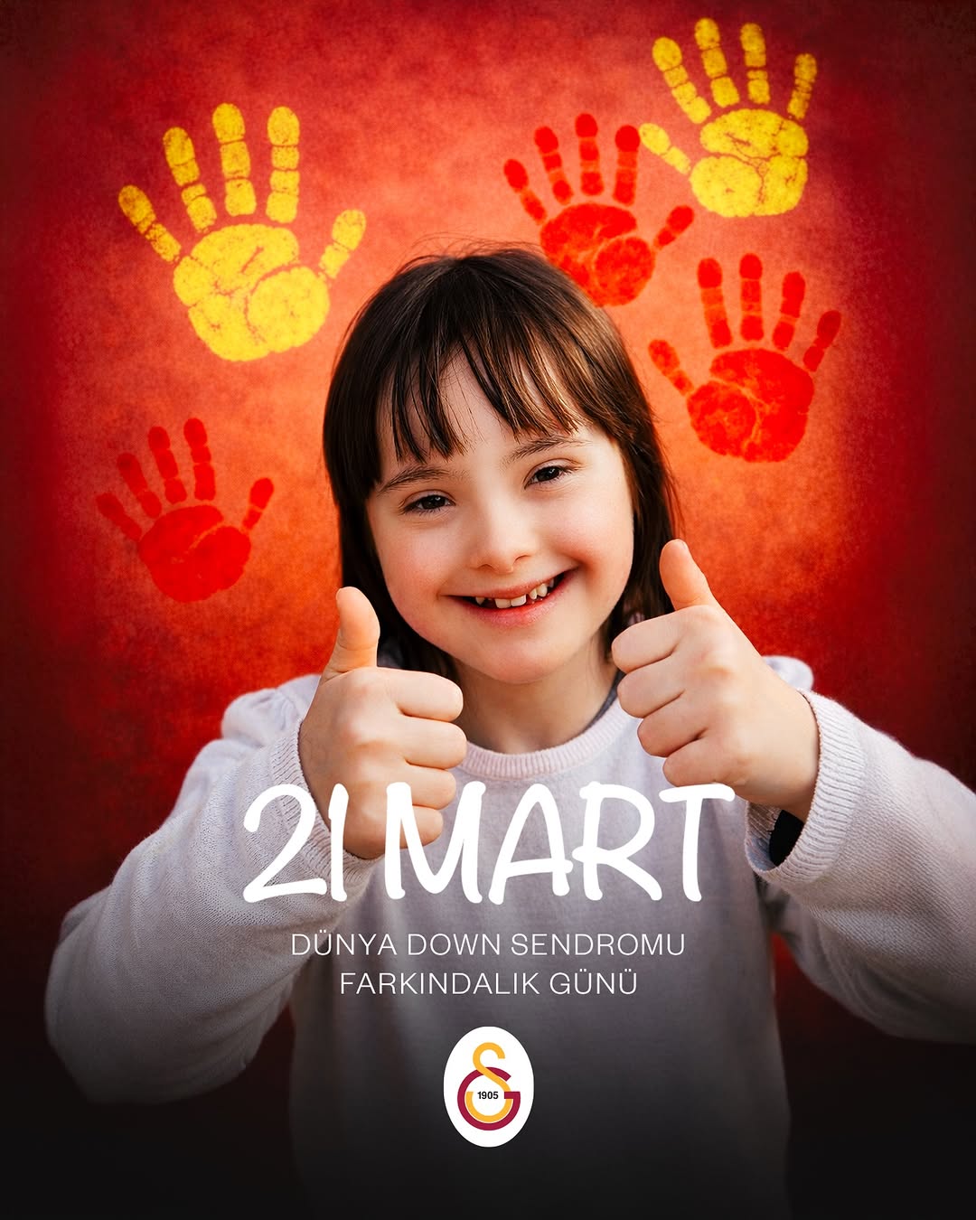 Dünya Down Sendromu Farkındalık Günü