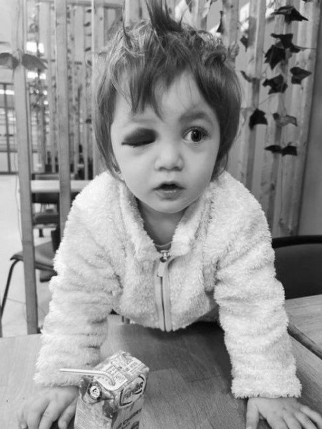 Yalova'da 14 Aylık Bebeğe Yönelen Şiddet Olayı