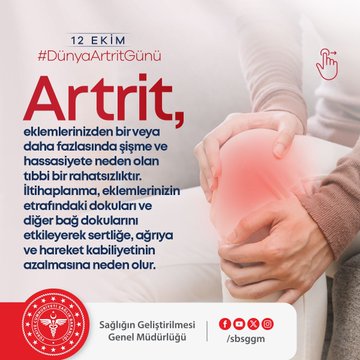 Eklem Rahatsızlığına Dikkat: Artrit ve Yönetim Yöntemleri