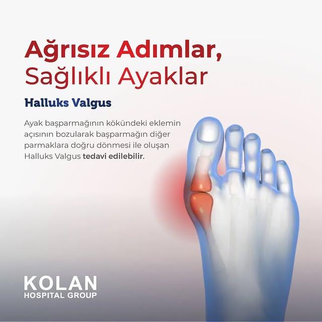 Ayak Deformitelerinde Doğru Ameliyat Yöntemi Nasıl Belirlenir?